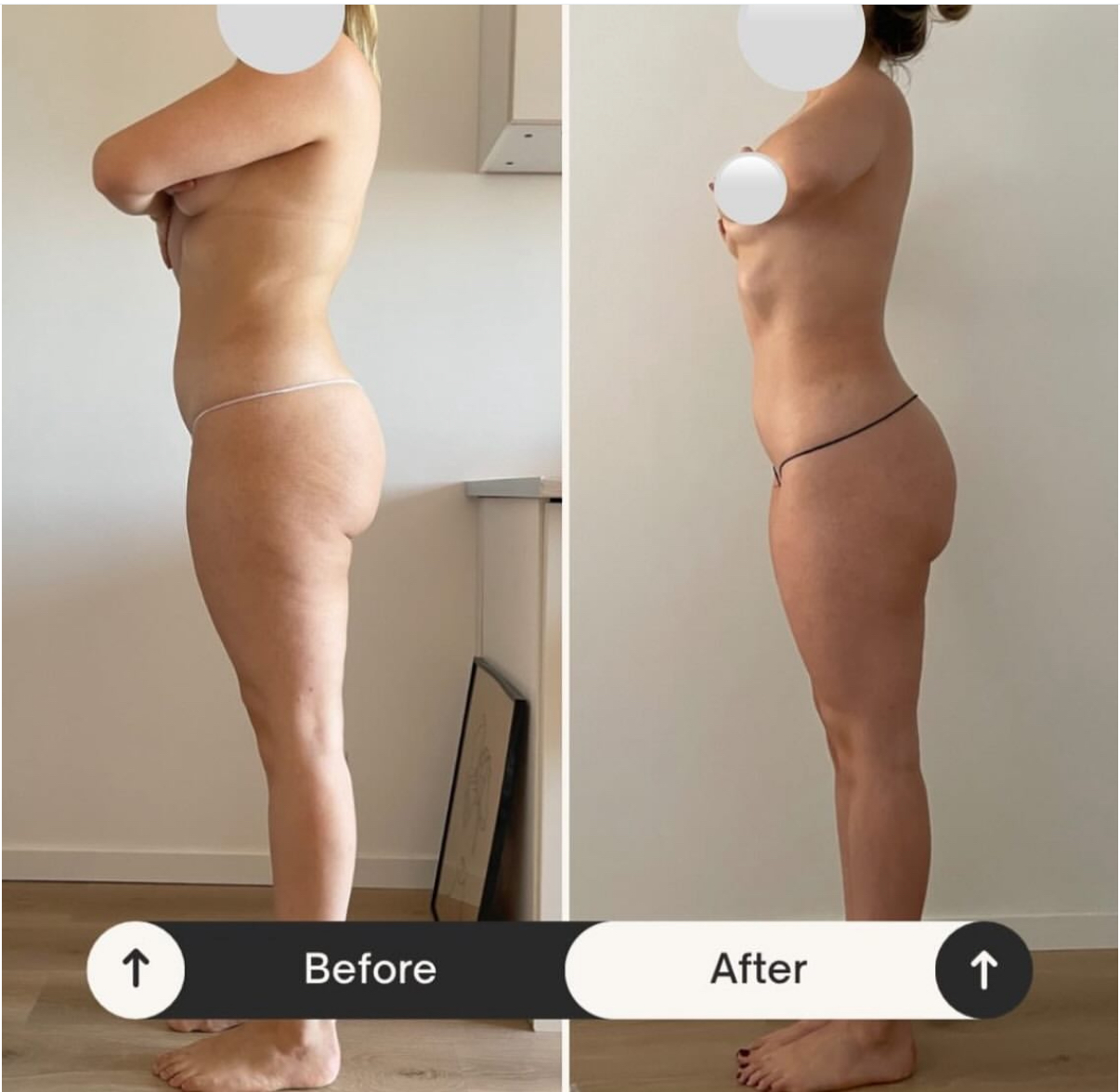 Avant Après Body Care