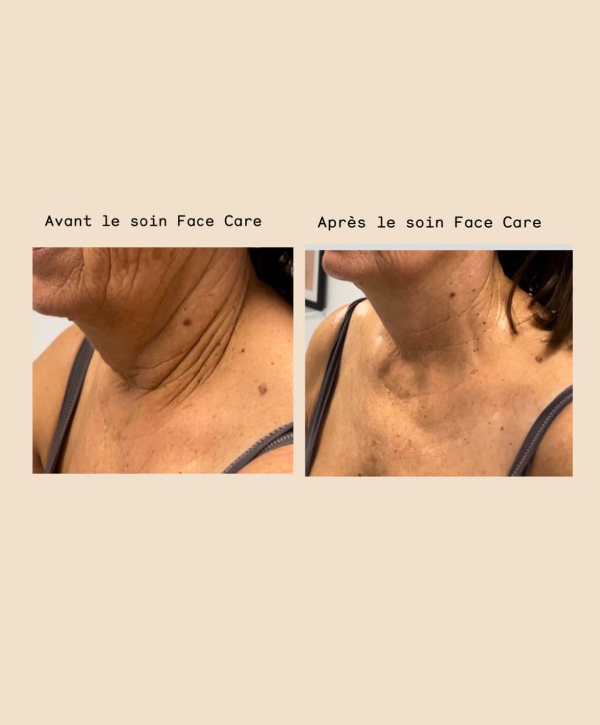 Avant Après Face Care